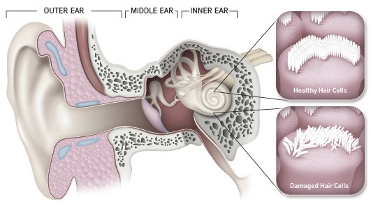 Tinnitus Thriving Inside And Out